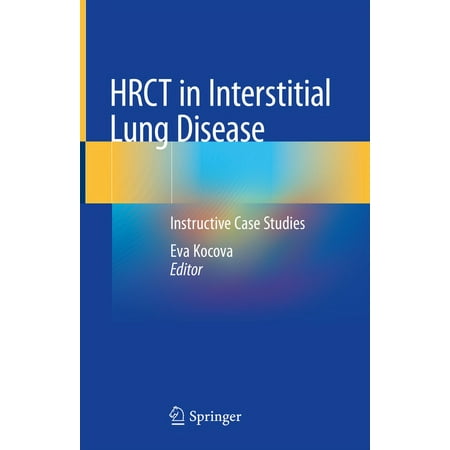 UPC: 9783030163143 | Hrct in Interstitial Lung Disease: Instructive Case Studies (Hardcover)