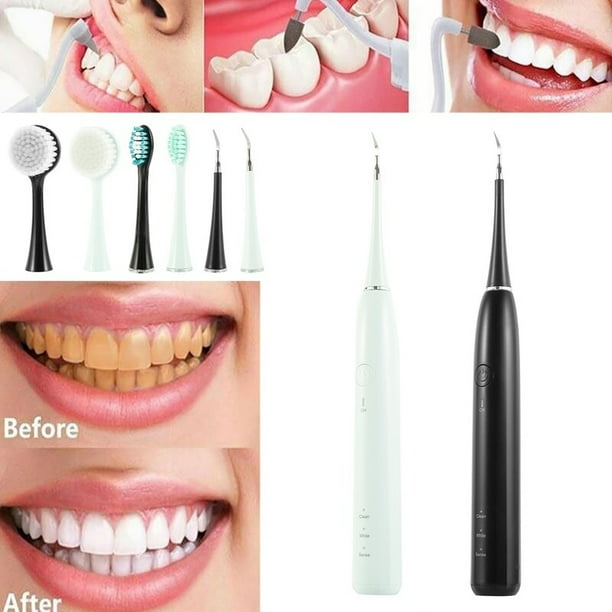 1 Set Ultrasonic Electric Tooth Cleaner Dental Stain Polisher Cleaning