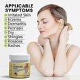 thumbnail image 5 of Psoriasis Treatments Cream, Skin Psoriasis Anti-Itch Cream, Soothing & Calming Multi-symptom Relief for Redness and Discomfort, 5 of 5