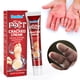 thumbnail image 1 of Hot6sl Ofertas y Liquidaciones Crema para Manos y Pies Agrietados Crema Antiagrietamiento y Secante, 1 of 7