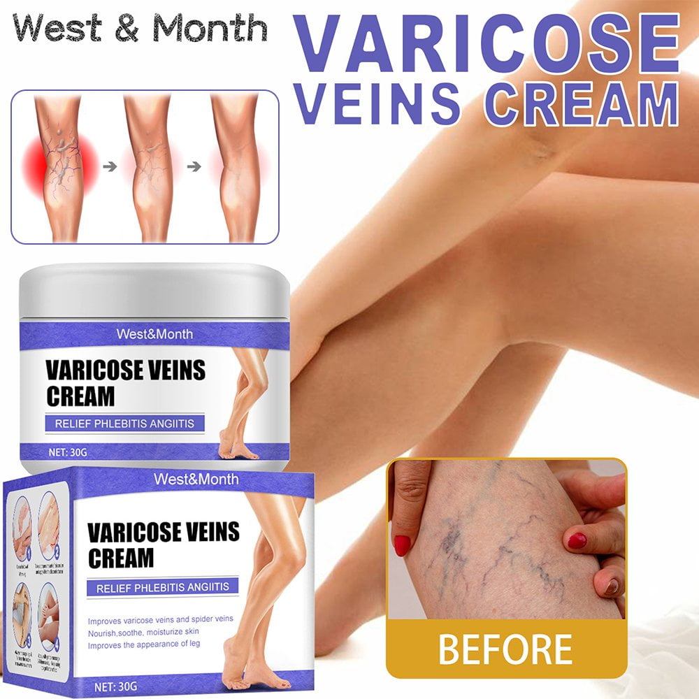 Vein Care Fading Cream Varicose Veins Cream for Legs Veins Herbal Ointment
