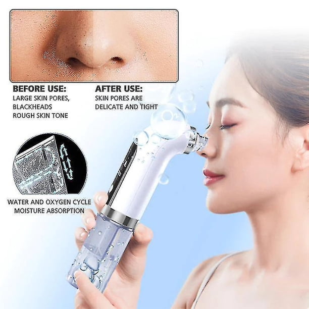 Espátula facial con vibración, depurador Facial, pala, cavitación limpia, exfoliante, removedor de clavo, depurador de piel