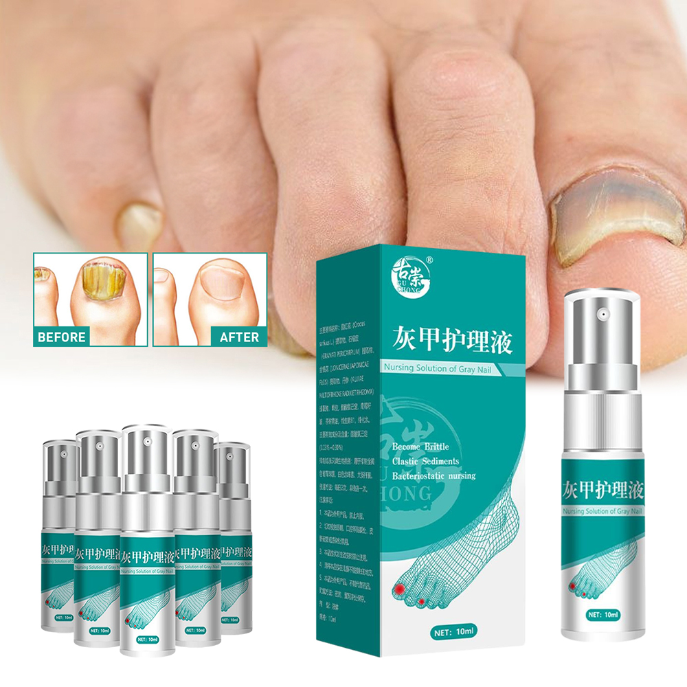 Ligghig Extra Strength Toenail Fungus Treatment for Toenail Nail Repair