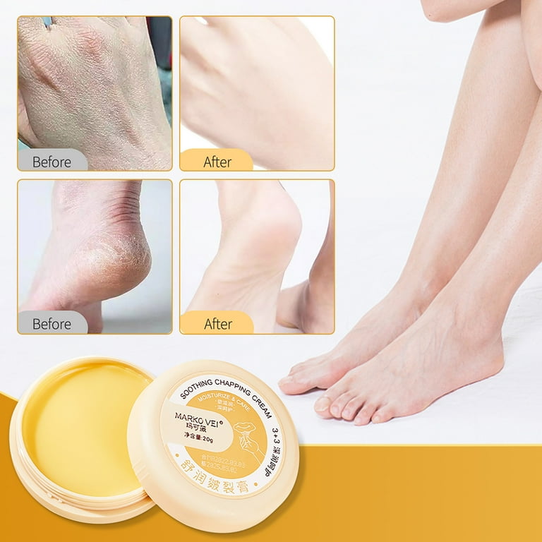 Cream for cracked feet and hands sale