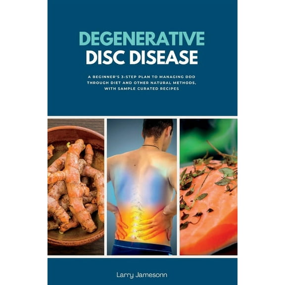 Degenerative Disc Disease: A Beginner's 3-Step Plan to Managing DDD Through Diet and Other Natural Methods, with Sample , (Paperback)