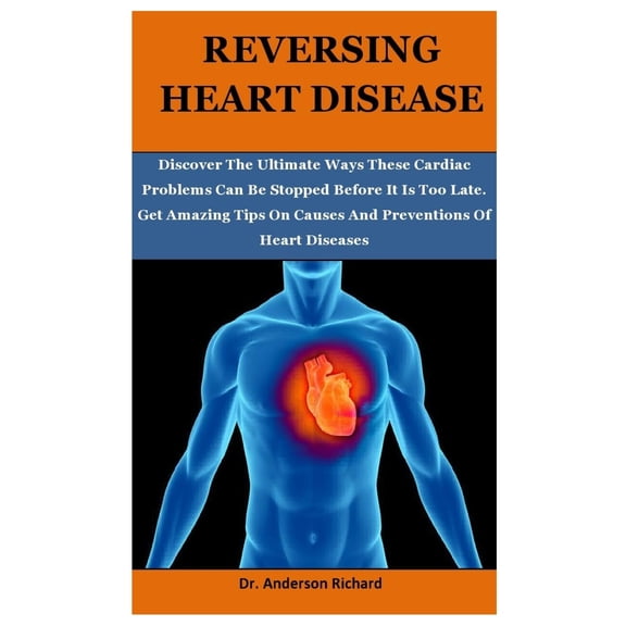 Reversing Heart Disease : Discover The Ultimate Ways These Cardiac Problems Can Be Stopped Before It Is Too Late, Get Amazing Tips On Causes And Preventions Of Heart Diseases (Paperback)