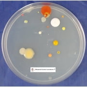 Pre-poured Nutrient Agar Plates and Swabs, Sterilized- 2, 100mm x 15mm Plates + 2 Sterile Swabs