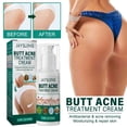 thumbnail image 1 of NARABB Butt Repair Cream, Removing Moisturizing , Repair Skin,Adjust Damaged Muscles, 1 of 9