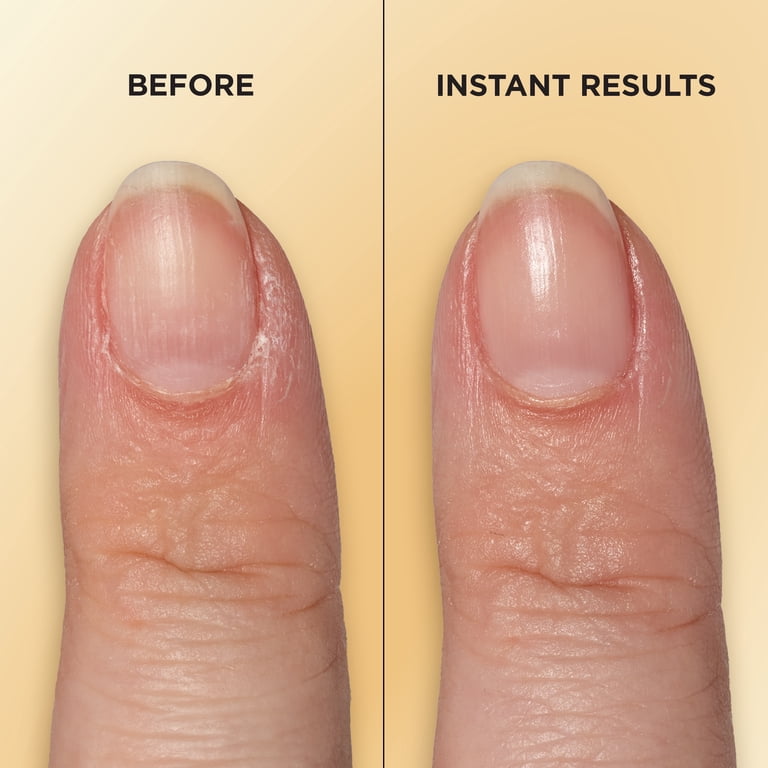 Sally Hansen Vitamin E Nail & Cuticle Oil Pen photo 4