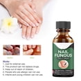 thumbnail image 1 of Lápiz quitauñas líquido de 30 ml para el cuidado de los pies y la onicomicosis, 1 of 7