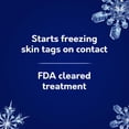 thumbnail image 4 of Removedor de Verrugas Cutáneas Compound W Freeze Off con 8 Aplicaciones, 4 of 7
