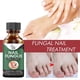 thumbnail image 2 of 50ML Nail Treatment Solution Nail Repair Liquid Accelerate Metabolism Onychomycosis Treatment Solution, 2 of 5