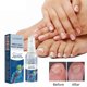 thumbnail image 1 of Clearance Antifungals Nail Treatments Spray In Medicals Quality, 30 Ml, Antifungals Nail Treatments, Antifungals Spray 30ml, 1 of 4