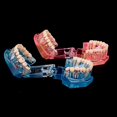 thumbnail image 4 of Dental Study Teeth Model Transparent Adult Pathological Disease Tooth Dentistry, 4 of 5