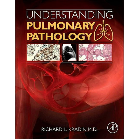 Understanding Pulmonary Pathology: Applying Pathological Findings in Therapeutic Decision Making, (Paperback)