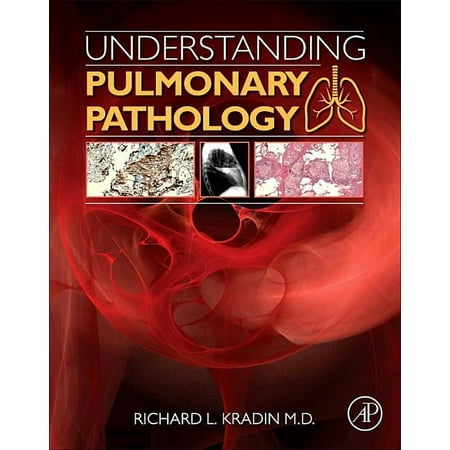 UPC: 9780128013045 | Understanding Pulmonary Pathology: Applying Pathological Findings in Therapeutic Decision Making (Paperback)