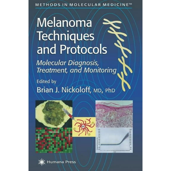 Methods in Molecular Medicine Melanoma Techniques and Protocols: Molecular Diagnosis, Treatment, and Monitoring, Book 61, (Paperback)