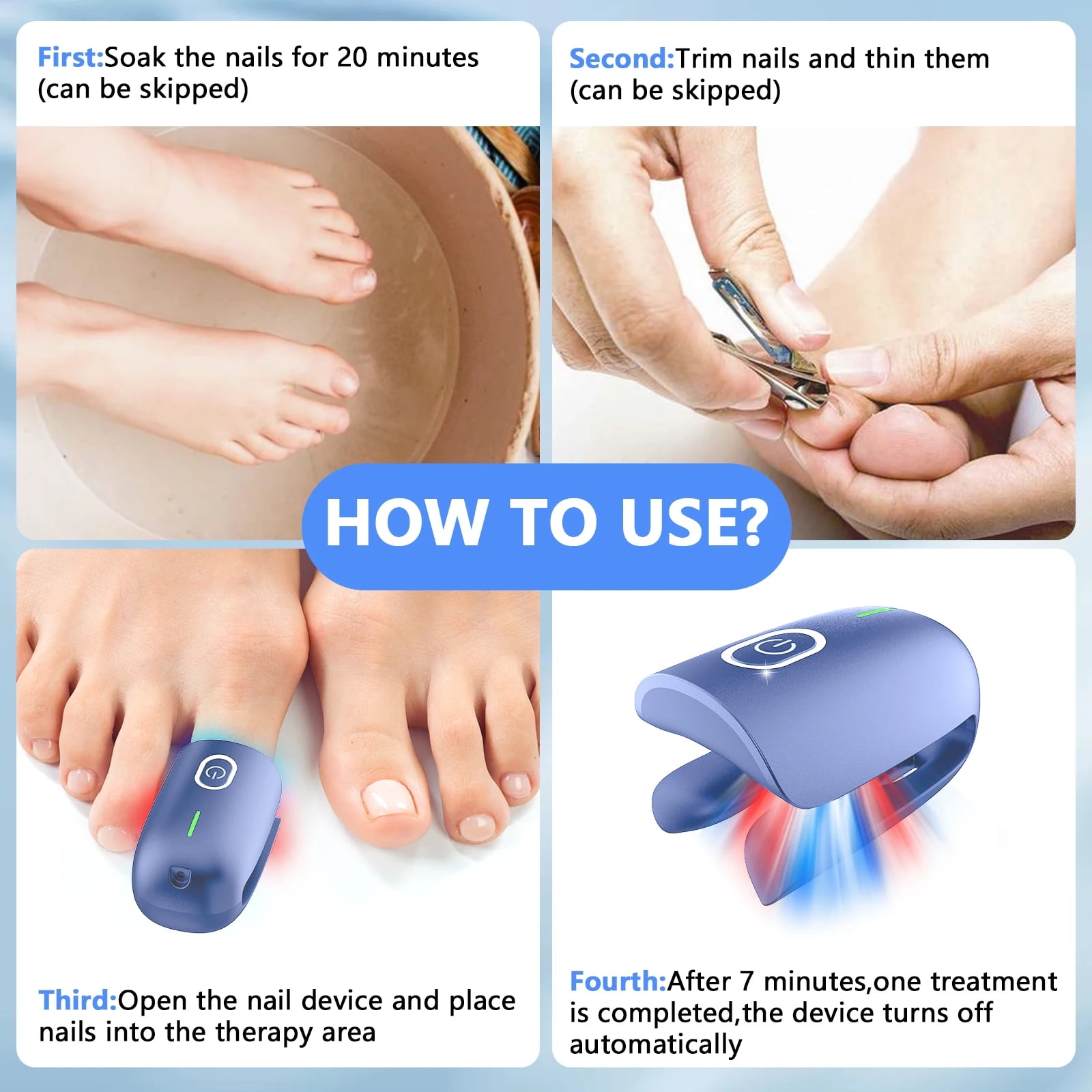 KTS Nail Fungus Cleaning Device Toenail Fungus Cleaning Machine Type-C Rechargeable Fungus Discolored Remover Portable for Home