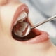 thumbnail image 4 of Espejo para odontología e higiene bucal - Acero inoxidable plateado, 4 of 5