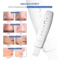 thumbnail image 4 of foreverLily Purificador de Piel Facial Port&aacute;til, Espatula Ultrasonica Facial, Peeling Ultras&oacute;nico Facial Skin Scrubber Exfoliaci&oacute;n Limpiador de Poros, Raspador de Punt, 4 of 9