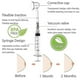 thumbnail image 1 of 2pcs For Day And 2pcs For Night Inverted Nipple Puller Aspirator Corrector Women Nipple Suckers For Flat Nipples, 1 of 4
