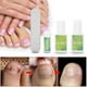 thumbnail image 4 of Juego De Herramientas De Pedicura Profesional, Recortador De Uñas De Los Pies, Fijador De Corrección De Uñas Encarnadas, Cuidado De Los Pies, 4 of 7