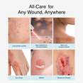 thumbnail image 2 of Easyderm Thin Hydrocolloid Wound Dressing, Waterproof, Latex-Free, 4 in x 4 in, 4 Count (2 Pack), 2 of 8
