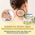 thumbnail image 4 of 1-3pcs Bee-venom Skin Treatments Cream Gentle Painless Wart Removing Cream For Women Men, 4 of 5