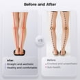thumbnail image 4 of O/X Leg Type Correction Belt, Adjustable Kids? Leg Posture Corrector for Knock Knees Valgus Deformity, Bow Legs Straightening Band with Air Pump for Kids Under 150cm / 5 Feet, 4 of 6