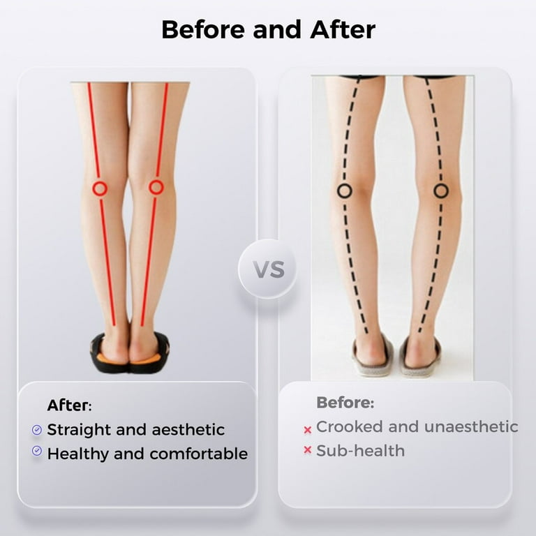 GHORTHOUD O/X Legs Correction Belt Legs Posture Corrector Band Unisex O/X  Legs Type Legs Bandage Lightweight Pediatric Straighten Belt for Men Women