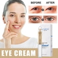 thumbnail image 3 of Fiudx Liquidación de ahorros de verano Crema para ojos que levanta bolsas de los ojos, atenúa las ojeras y líneas finas, suero para ojos, crema para ojos, 1 ml, 3 of 7