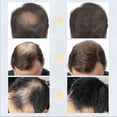thumbnail image 4 of Hair Thickening Spray With Keratin Hair Building Fibers 100g Instant Wig Regrowth Powder Refill, 4 of 6