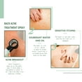Jaysuing Back Acne Repair Spray Repairs Body Acne and Lightens Acne Scars Skin Care Spray