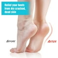 thumbnail image 3 of Moisturizing Heel Gel Socks: Heal Dry Cracked Heel Treatment Overnight Pedicure Foot Spa Sock | 2 Pairs Soft Silicone Moisturizer Sleeve to Repair Callus Rough Heel, 3 of 5