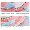 thumbnail image 4 of 2-pack orthodontic care cleaning toothbrush irregular small pointed toothbrush braces special toothbrush (rose red + blue), 4 of 4
