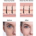 thumbnail image 3 of Máquina de Reducción de arrugas YONGSHENG Masajeador Facial Antienvejecimiento, 3 of 5