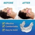 thumbnail image 3 of Anti Snoring Bruxism Mouth Guard Improve Sleeping Teeth Bruxism Sleeping Anti Snoring And Apnea Snoring Device To Stop Snoring, 3 of 4