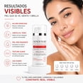 thumbnail image 2 of Crema Aclaradora SkinDemare | Axilas, Zona Íntima y Entrepiernas | Con Arbutina y Ácido Kójico | Sin Parabenos | 120ml, 2 of 6