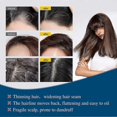 thumbnail image 3 of unique Forte Hair Lotion, Hair Growth Ampoule Serum Lotion, Hair Growth Serum With Androgen and DHT Blockers For Thinning Hair Promotes Stronger Thick, 3 of 5