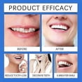 thumbnail image 3 of Silicone Relinedenture Set, Denture Reline Kit, Denture Set, 3 of 5