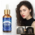 thumbnail image 4 of Xihbxyly La mejor oferta Acetic capilar denso de romero, loción capilar hidratante para cuero cabelludo, cuidado capilar denso y suave, 30 ml, 4 of 7