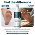 thumbnail image 4 of Marie Originals Athletes Foot Spray, Antifungal Treatment, Itch Relief and Foot Deodorant for Women and Men Travel, and Work, 4 Fl. Oz, 4 of 10