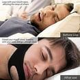 thumbnail image 2 of Stop Snoring CPAP Chin Strap and Anti Snoring Solution,Adjustable Anti-Snore Supporter Device (Blue Strap), 2 of 7