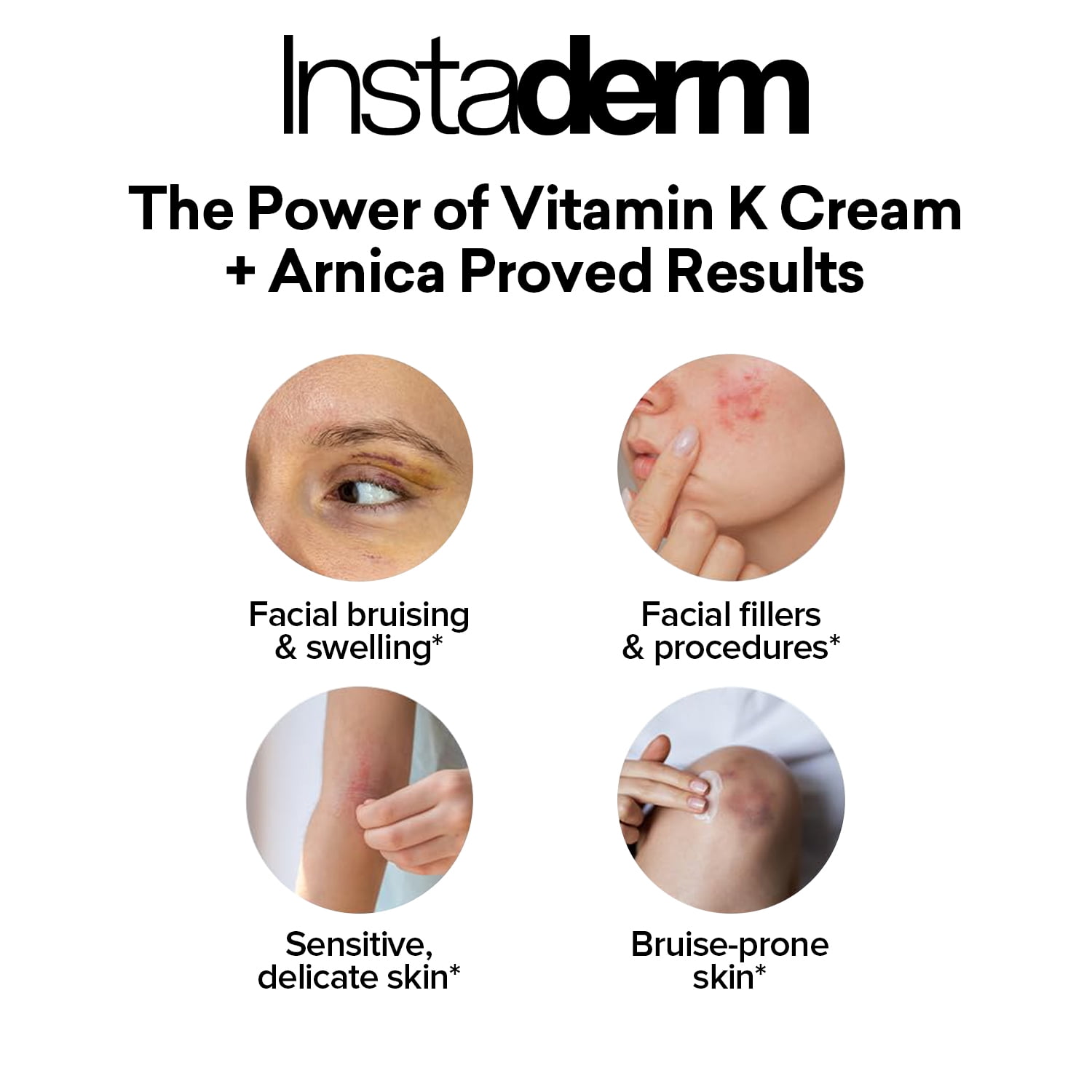 Vitamin K Cream- Bruise Healing Formula with Arnica. Dark Spot Moisturizer for Bruising, Spider Veins & Broken Capillaries. Repair Under Eye Dark Circles, Fine Lines, Puffiness, Wrinkles Face & Body.