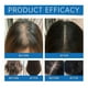 thumbnail image 4 of Scalp Cooling Hair Growth Serum Roller, Scalp Cooling Hair Ampoule for Men Women, Hair Loss Treatment Serum for All Hair Types, 4 of 5