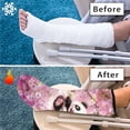 thumbnail image 7 of COEQINE Panda 2 Pack Leg Cast Covers Flower Cast Sleeve for Foot Leg Protector Washable Cast and Bandage Protector Below The Knee Leg Cast Sleeve Decorative Cover for Kids Girls Large, 7 of 7