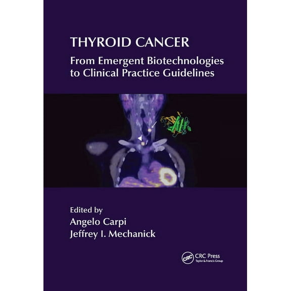 Thyroid Cancer: From Emergent Biotechnologies to Clinical Practice Guidelines, (Paperback)