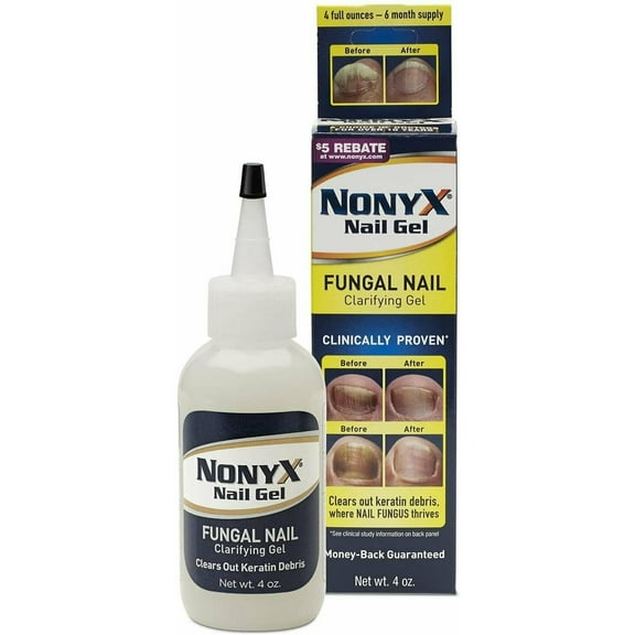 Nonyx Fungal Nail Clarifying Gel, Clears Out Keratin Debris 4 oz, Pack of 2