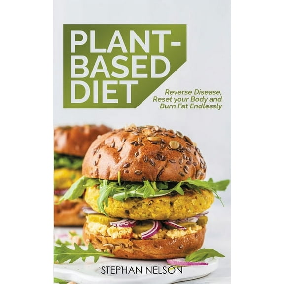 Plant-Based Diet: How to Lose Weight, Improve Your Health and Make Plant-Based Diet a Lifestyle: 30  Delicious and Easy , (Paperback)