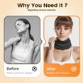 thumbnail image 4 of Adjustable Foam Neck Brace, Soft Cervical Collar for Neck Pain Relief & Sleep Support, 4 of 7